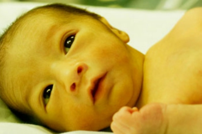 Патологическая желтуха у новорожденных