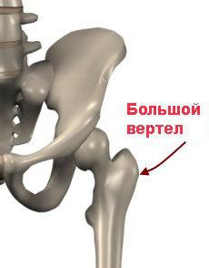 большие вертела бедренной кости