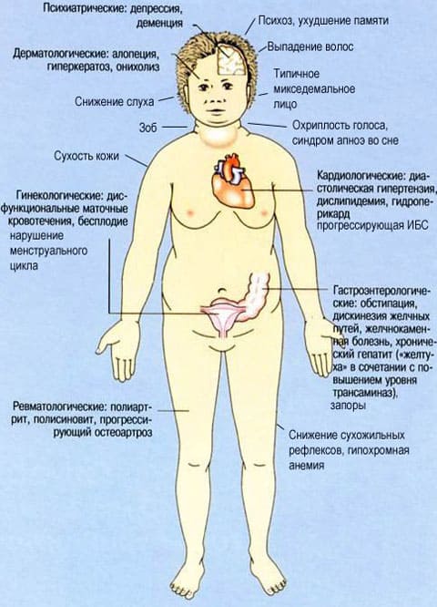 Симптомы гипотиреоза