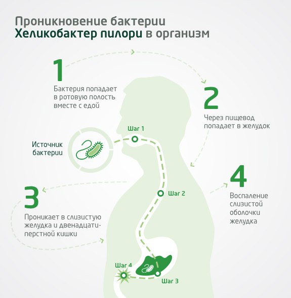 Бактерия хеликобактер: симптомы и причины