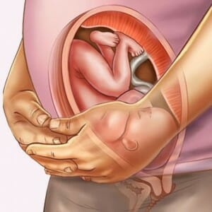 Беременность и эндометрит