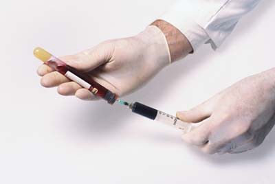 анализ крови на гепатит
