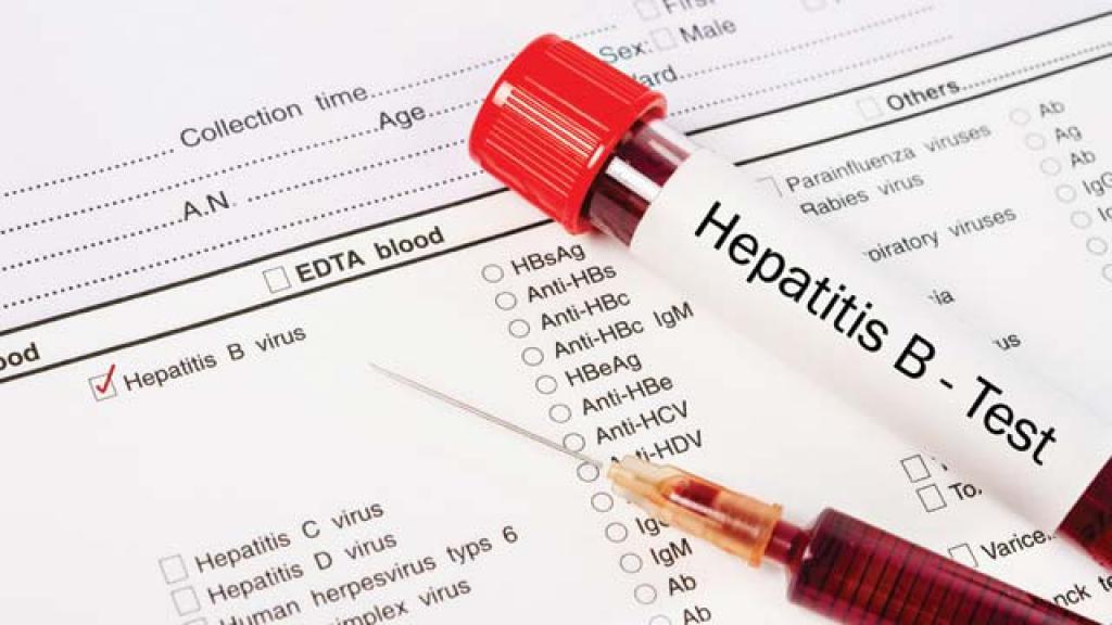 вирус гепатита b